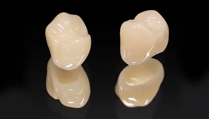 クラウン（被せ物）