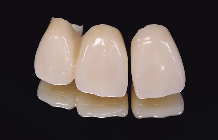 オールセラミックス