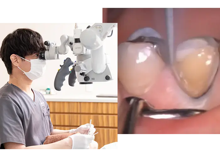 マイクロスコープ