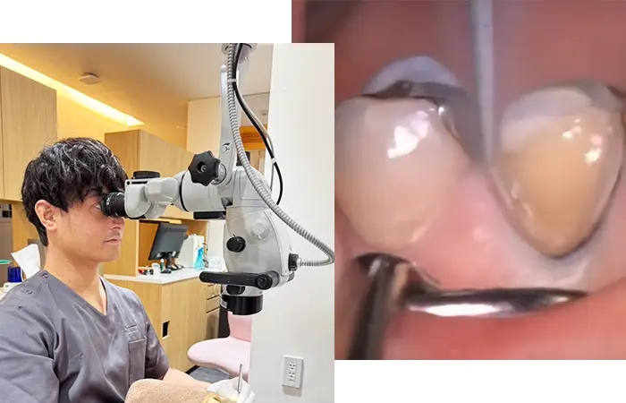 マイクロスコープ