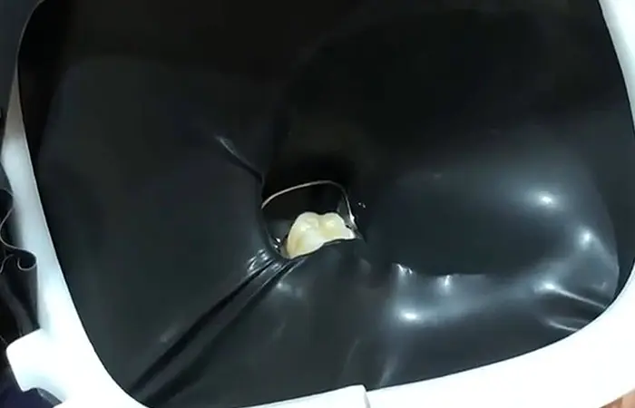 ラバーダム防湿