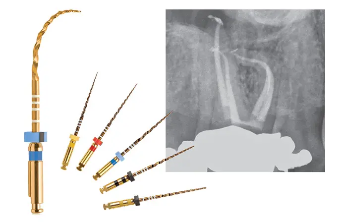 ニッケルチタンファイル