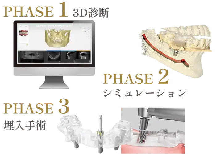 オステムワンガイド