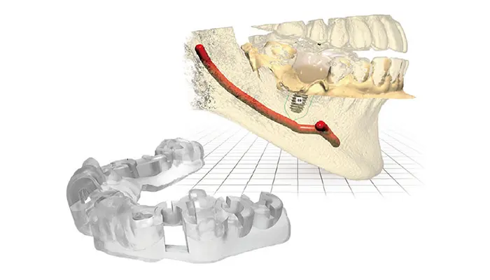 手術を簡単かつ安全に