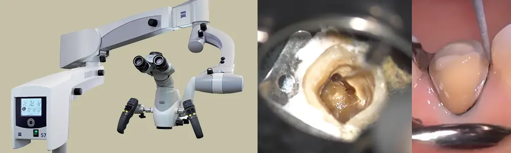 マイクロスコープ