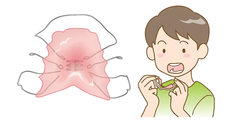 第Ⅰ期矯正治療