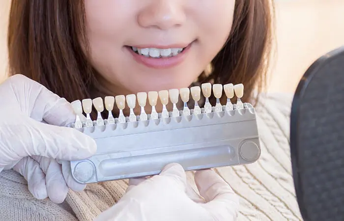 シェードテイキング