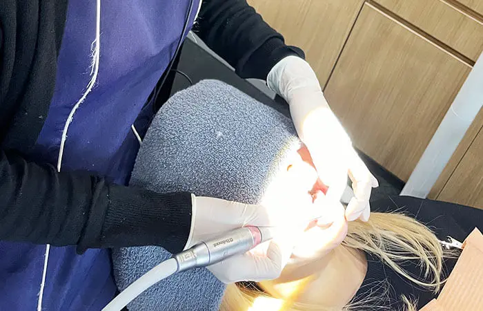 施術：クリーニング