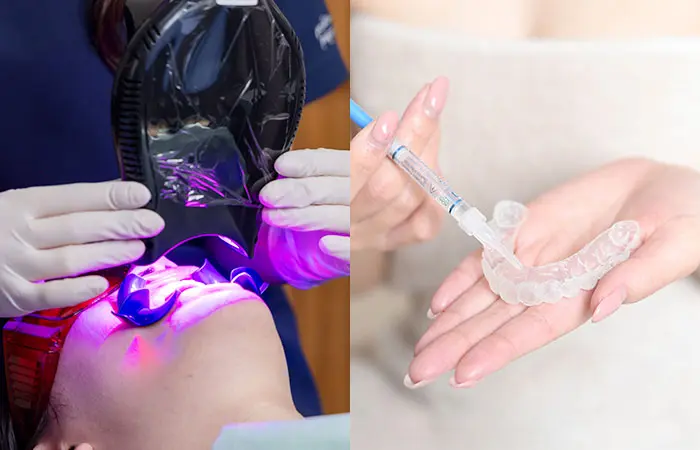 デュアルホワイトニング